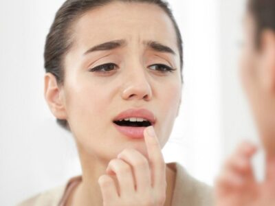 Cara Menghilangkan Bibir Hitam Agar Makin Percaya Diri