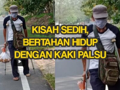 Cerita Kehidupan Sang Penjual Tahu Sumedang yang Berkaki Palsu