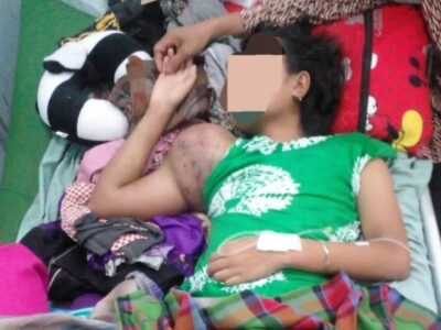 Idap Tumor Ganas, Remaja Asal Seluma Ini Butuh Uluran Tangan