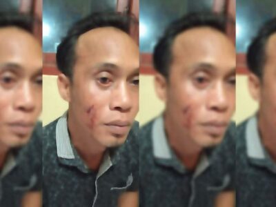 Seorang Pria di Seluma Dihantam Batu, Pelaku Diduga Anggota PPS